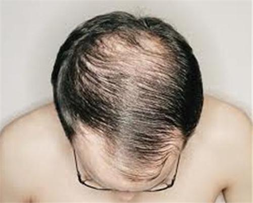 4876 6 TocLaoHoaNCaliST